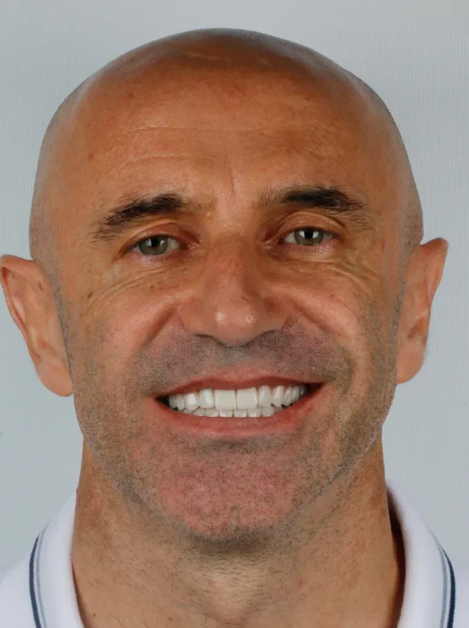 Depois: Carlos Eduardo, perfil