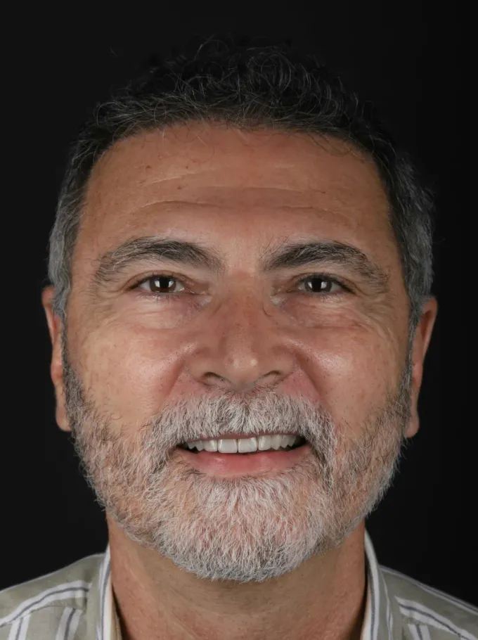 Depois: Carlos Pereira, perfil
