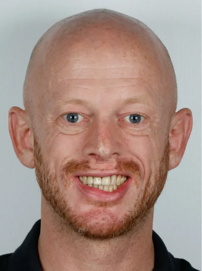 Antes: Kenny Chevalier, perfil