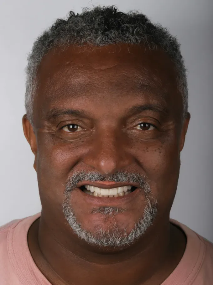 Depois: Luis Claudio, perfil