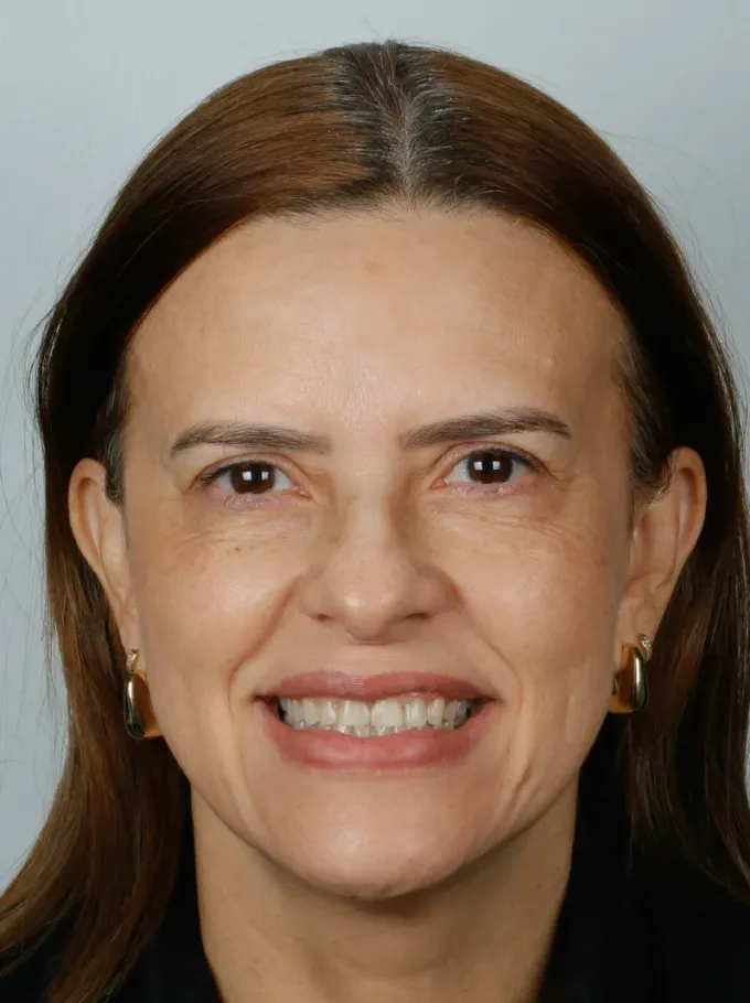 Antes: Marcia Ximenes, perfil