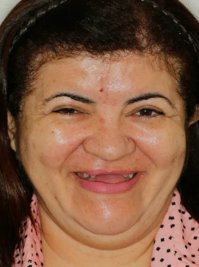 Antes: Maria Senhora, perfil
