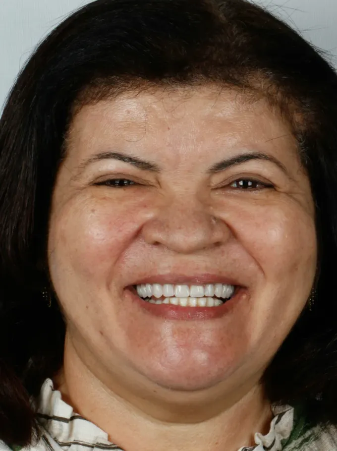 Depois: Maria Senhora, perfil