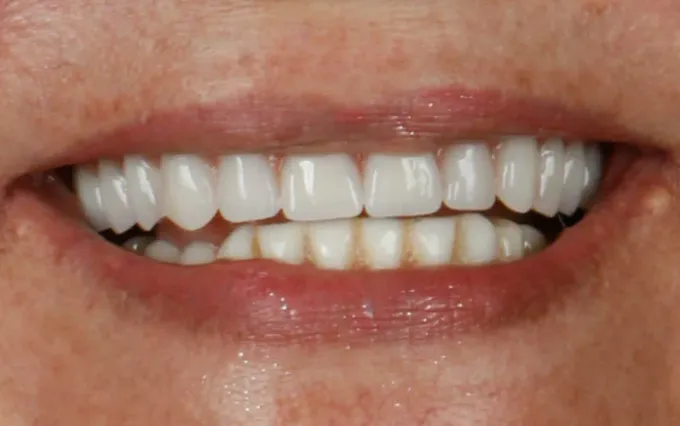 Depois: Maria Senhora, sorriso