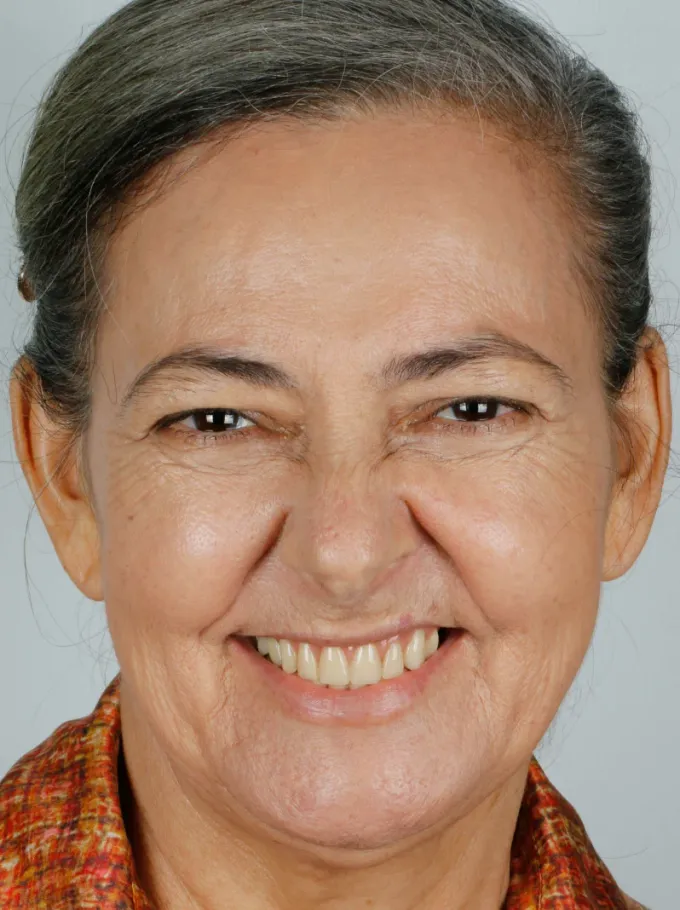 Antes: Maria Targino, perfil